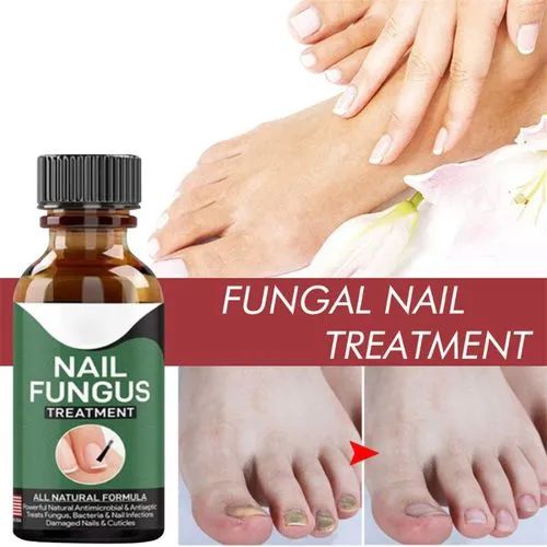 Nail Fungal Treatments